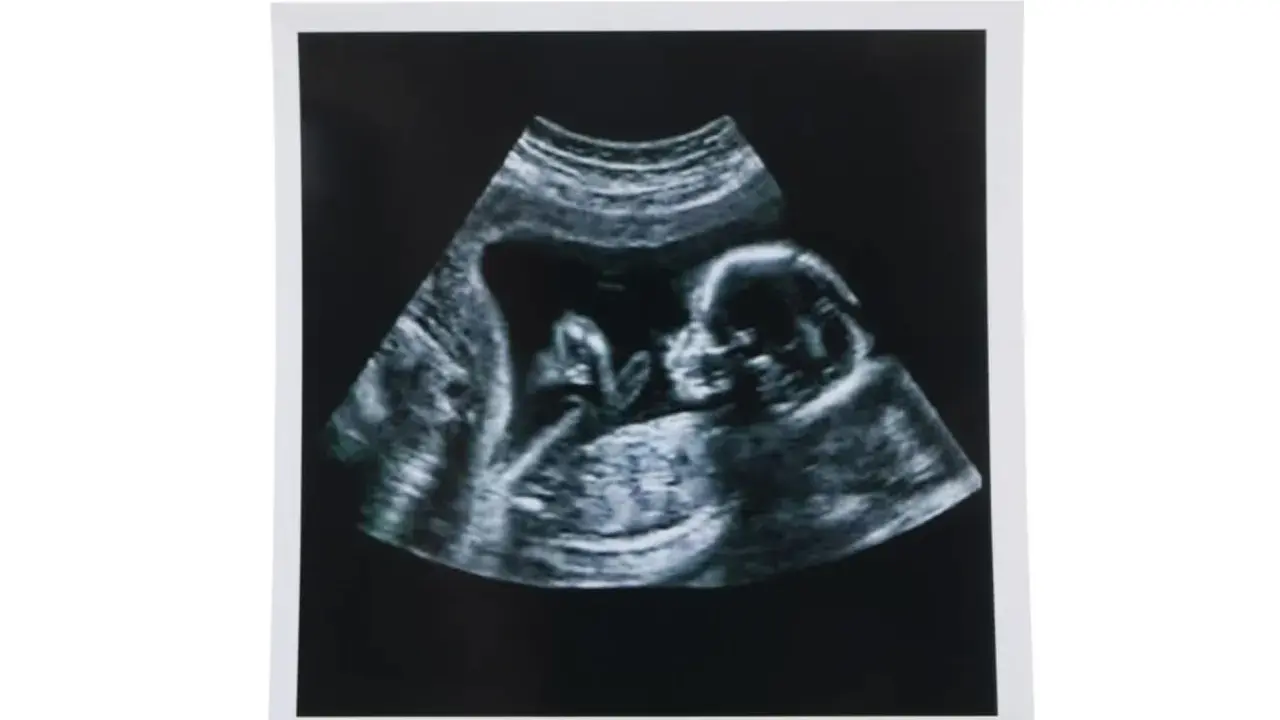 USG w 12 tygodniu ciąży pokazuje profil dziecka. To ważny etap, jak wyglądają badania prenatalne.