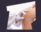 Zastrzyk z kwasem hialuronowym na stawy. Lekarz w białej rękawiczce podaje zastrzyk w kolano.