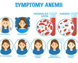 Objawy anemii: bóle głowy, bezsenność, płytki oddech, zmęczenie, zawroty głowy, problemy z koncentracją, bladość skóry. Czy anemia jest groźna? Obrazek pokazuje różnicę między normalną krwią a krwią w anemii.