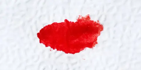 Plama krwi na białym materiale, przypominająca ślady po problemach z odbytem.