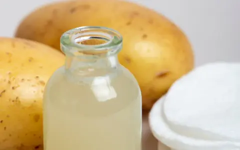 Naturalny sok z ziemniaka w buteleczce, obok surowych ziemniaków i wacików. Idealny do domowych zabiegów pielęgnacyjnych.
