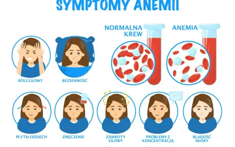 Objawy anemii: bóle głowy, bezsenność, płytki oddech, zmęczenie, zawroty głowy, problemy z koncentracją, bladość skóry. Czy anemia jest groźna? Obrazek pokazuje różnicę między normalną krwią a krwią w anemii.