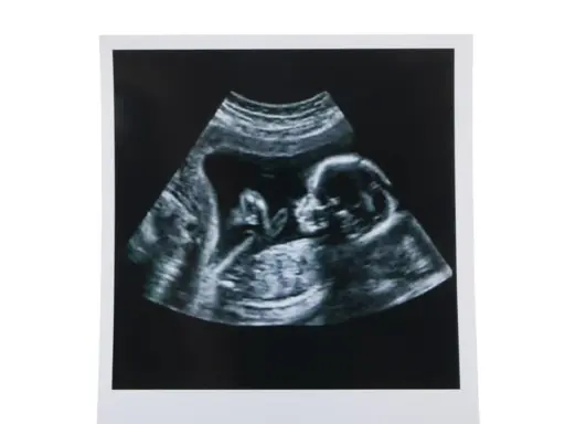 USG w 12 tygodniu ciąży pokazuje profil dziecka. To ważny etap, jak wyglądają badania prenatalne.