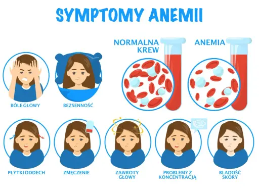 Objawy anemii: bóle głowy, bezsenność, płytki oddech, zmęczenie, zawroty głowy, problemy z koncentracją, bladość skóry. Czy anemia jest groźna? Obrazek pokazuje różnicę między normalną krwią a krwią w anemii.