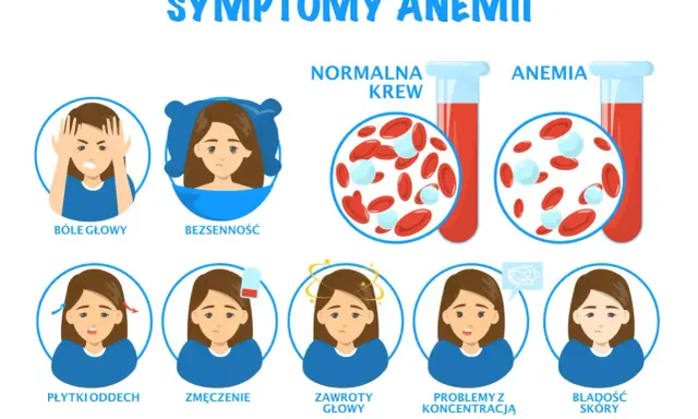 Objawy anemii: bóle głowy, bezsenność, płytki oddech, zmęczenie, zawroty głowy, problemy z koncentracją, bladość skóry. Czy anemia jest groźna? Obrazek pokazuje różnicę między normalną krwią a krwią w anemii.