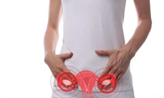 Kobieta z rękami na podbrzuszu, gdzie widoczny jest zarys narządów rodnych z zaznaczonymi czerwonymi okręgami. Ilustracja sugeruje torbiel na jajniku objawy.