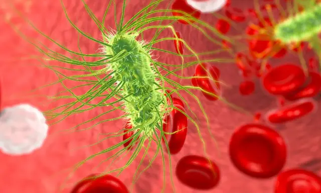 Bakteria escherichia coli w moczu, otoczona czerwonymi krwinkami.