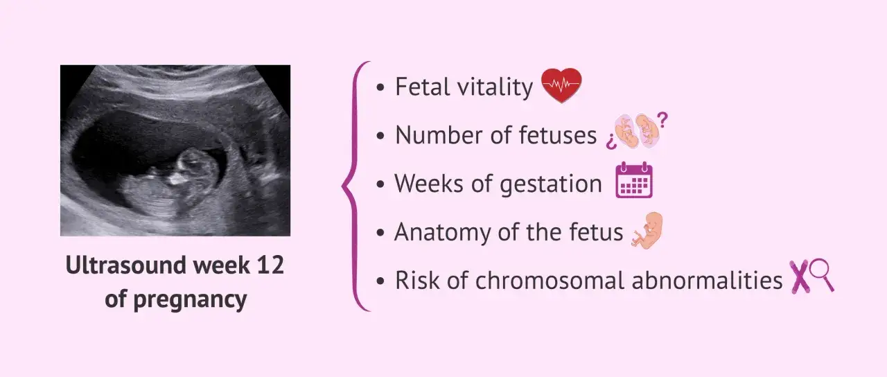 Badania prenatalne w 12 tygodniu ciąży: ocena żywotności płodu, liczby płodów, tygodnia ciąży, anatomii i ryzyka wad.